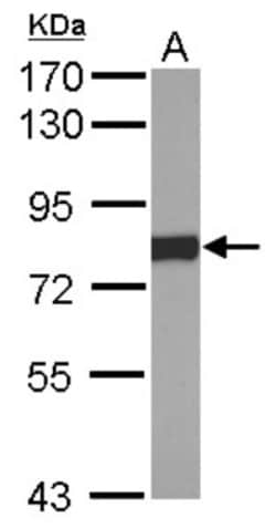 POR/Cytochrome P450 Reductase Antibody, Novus Biologicals 0.1mL; Unlabeled:Antibodies,