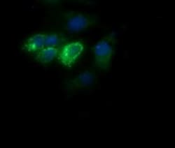 Cytochrome C Oxidase subunit 6c Antibody (OTI4B11), Novus Biologicals 0.1mL;