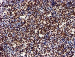 Cytochrome P450 17A1 Antibody (OTI3F11), Novus Biologicals 0.1mL; Unlabeled:Antibodies,