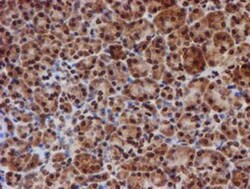 Cytochrome P450 17A1 Antibody (OTI3F11), Novus Biologicals 0.1mL; Unlabeled:Antibodies,