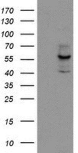 Cytochrome P450 17A1 Antibody (OTI3F11), Novus Biologicals 0.1mL; Unlabeled:Antibodies,