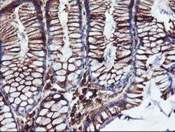 Cytochrome P450 2B6 Antibody (OTI3D5), Novus Biologicals 0.1mL; Unlabeled:Antibodies,