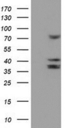 Cytochrome P450 2B6 Antibody (OTI3D5), Novus Biologicals 0.1mL; Unlabeled:Antibodies,