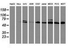Cytochrome P450 2B6 Antibody (OTI3D5), Novus Biologicals 0.1mL; Unlabeled:Antibodies,