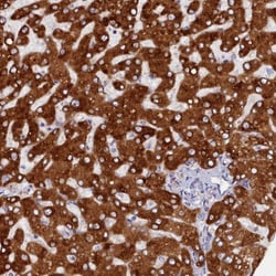 Cytochrome P450 2D6 Antibody, Novus Biologicals 25 &mu;L, Unconjugated:Antibodies,