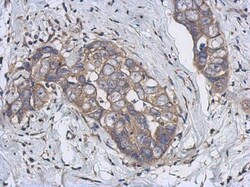 Cytochrome p450 2J2 Antibody, Novus Biologicals 0.1mL; Unlabeled:Antibodies,