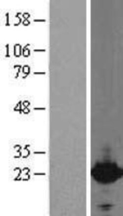 Novus Biologicals&trade;&nbsp;Cytoglobin Overexpression Lysate