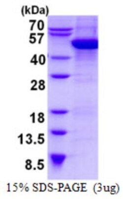 Novus Biologicals&trade;&nbsp;Recombinant Human Cytohesin 2 His Protein