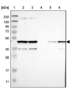 Cytohesin 3 Antibody, Novus Biologicals 25 &mu;L; Unlabeled:Antibodies,