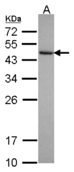 Cytohesin 3 Antibody, Novus Biologicals 0.1mL; Unlabeled:Antibodies, Polyclonal