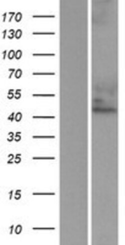 Novus Biologicals&trade;&nbsp;Cytohesin 3 Overexpression Lysate