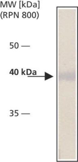 Cytohesin 2 Antibody (CYT2-21) - BSA Free, Novus Biologicals 0.05mL; Unlabeled:Antibodies,