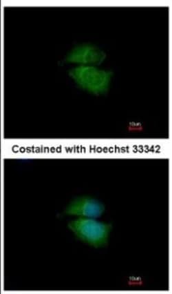 Cytohesin 3 Antibody, Novus Biologicals 0.1mL; Unlabeled:Antibodies, Polyclonal