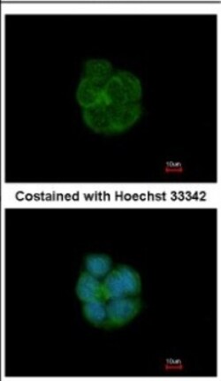 Cytokeratin 13 Antibody, Novus Biologicals 0.1mL; Unlabeled:Antibodies,