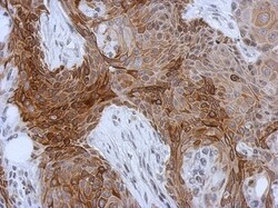 Cytokeratin 13 Antibody, Novus Biologicals 0.1mL; Unlabeled:Antibodies,