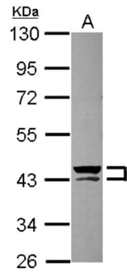 Cytokeratin 13 Antibody, Novus Biologicals 0.1mL; Unlabeled:Antibodies,