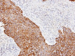 Cytokeratin 14 Antibody, Novus Biologicals 0.1mL; Unlabeled:Antibodies,