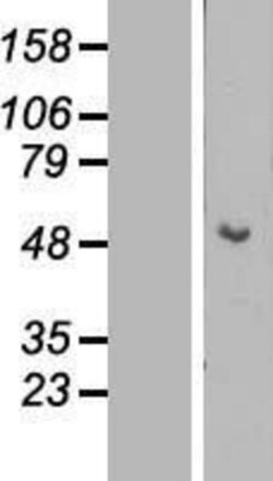 Novus Biologicals&trade;&nbsp;Cytokeratin 15 Overexpression Lysate