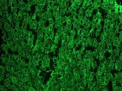 Cytokeratin 18 Antibody (RGE53) - BSA Free, Novus Biologicals 0.1mg; Unlabeled:Antibodies,