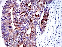 Cytokeratin 19 Antibody (4E8) - BSA Free, Novus Biologicals 0.1mL; Unlabeled:Antibodies,