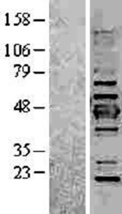Novus Biologicals&trade;&nbsp;Cytokeratin 19 Overexpression Lysate