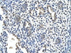 Cytokeratin 2 Antibody, Novus Biologicals 0.05mg; Unlabeled:Antibodies,