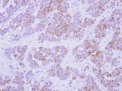 Cytokeratin 2 Antibody, Novus Biologicals 0.1 mL | Buy Online | Novus Biologicals | Fisher Scientific