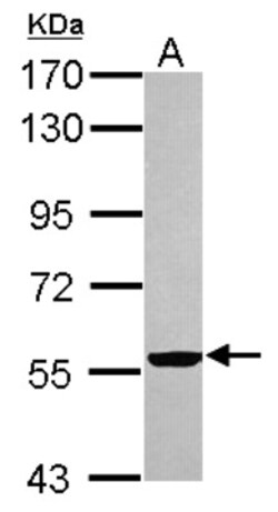 Cytokeratin 2 Antibody, Novus Biologicals 0.1 mL | Buy Online | Novus Biologicals | Fisher Scientific