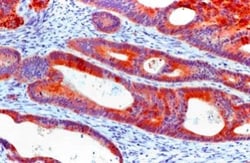Cytokeratin 20 Antibody (Ks20.8), Novus Biologicals 0.1 mL; Unconjugated:Antibodies,