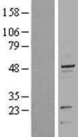 Novus Biologicals&trade;&nbsp;Cytokeratin 20 Overexpression Lysate