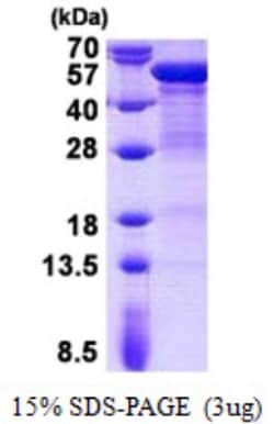 Novus Biologicals&trade;&nbsp;Recombinant Human Cytokeratin 20 His Protein