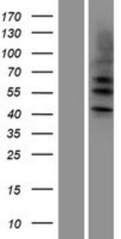 Novus Biologicals&trade;&nbsp;Cytokeratin 4 Overexpression Lysate