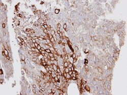 Cytokeratin 6a Antibody, Novus Biologicals 0.1mL; Unlabeled:Antibodies,