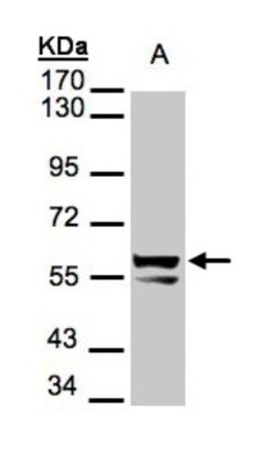 Cytokeratin 6a Antibody, Novus Biologicals 0.1mL; Unlabeled:Antibodies,