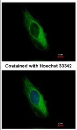 Cytokeratin 6b Antibody, Novus Biologicals 0.1mL; Unlabeled:Antibodies,