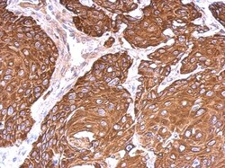 Cytokeratin 6b Antibody, Novus Biologicals 0.1mL; Unlabeled:Antibodies,