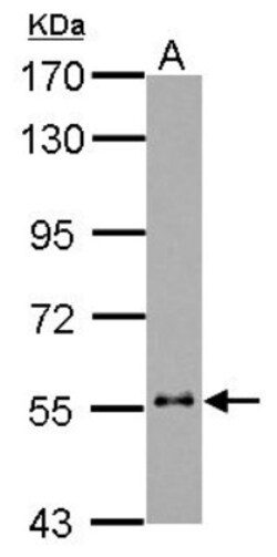 Cytokeratin 6b Antibody, Novus Biologicals 0.1mL; Unlabeled:Antibodies,