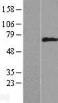 Novus Biologicals&trade;&nbsp;Cytokeratin 6b Overexpression Lysate