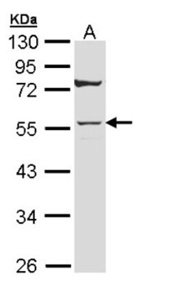 Cytokeratin 7 Antibody, Novus Biologicals 0.1mg; Unlabeled:Anticuerpos