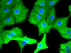 Cytokeratin 8 Antibody (OTI1B12), Novus Biologicals 0.1mL; Unlabeled:Antibodies,