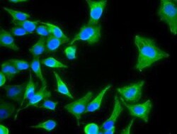Cytokeratin 8 Antibody (OTI1B12), Novus Biologicals 0.1mL; Unlabeled:Antibodies,