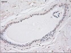 Cytokeratin 8 Antibody (OTI1B12), Novus Biologicals 0.1mL; Unlabeled:Antibodies,