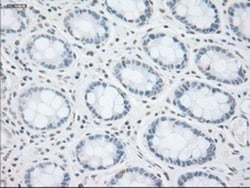 Cytokeratin 8 Antibody (OTI1B12), Novus Biologicals 0.1mL; Unlabeled:Antibodies,