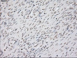 Cytokeratin 8 Antibody (OTI1B12), Novus Biologicals 0.1mL; Unlabeled:Antibodies,