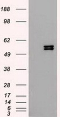 Cytokeratin 8 Antibody (OTI1B12), Novus Biologicals 0.1mL; Unlabeled:Antibodies,
