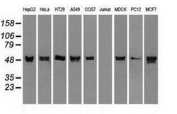 Cytokeratin 8 Antibody (OTI1B12), Novus Biologicals 0.1mL; Unlabeled:Antibodies,