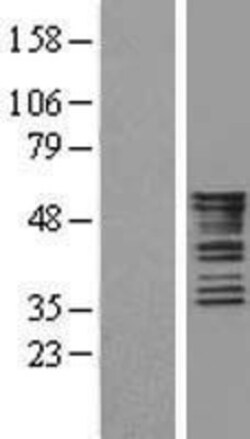Novus Biologicals&trade;&nbsp;Cytokeratin 8 Overexpression Lysate