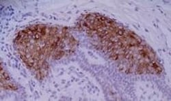 Cytokeratin 10 Antibody (VIK-10) - BSA Free, Novus Biologicals 0.1mg; Unlabeled:Antibodies,