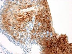 Cytokeratin 13 Antibody (KS-1A3), Novus Biologicals:Antibodies:Primary