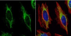 Cytokeratin 14 Antibody, Novus Biologicals 0.1mL; Unlabeled:Antibodies,